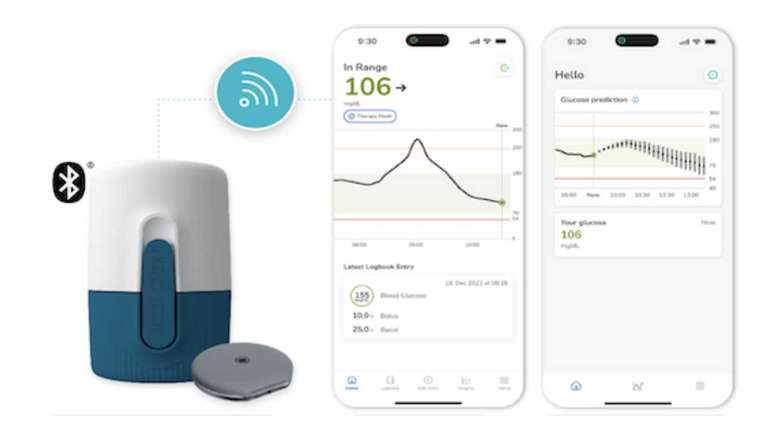 Sensor de glicose prevê hipoglicemia