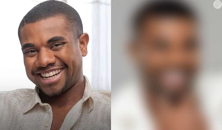 Davi Brito, campeão do 'BBB 24', coloca lentes nos dentes e novo sorriso divide opiniões: 'Tá igual um piano'. Veja antes e depois!.