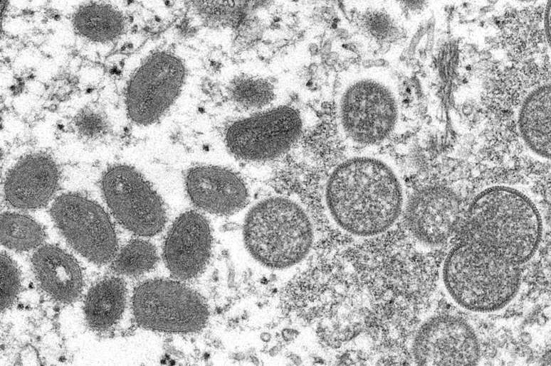 Visão de microscópio eletrônico do vírus da varíola do macaco, mostrando partículas de vírus maduras de formato oval e virions esféricos imaturos