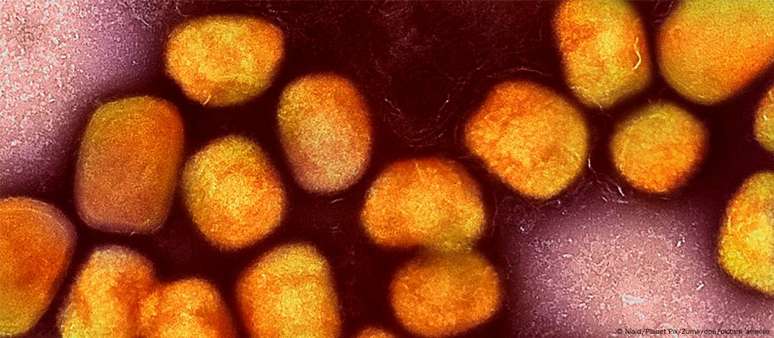 Uma imagem microscópica de partículas do vírus mpox; doença é menos contagiosa que a covid-19