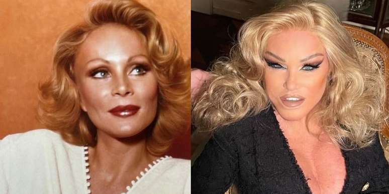 Antes e depois da socialite Jocelyn Wildenstein