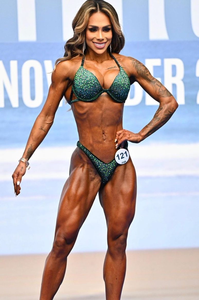 A atleta brasileira de fisiculturismo Val Santana disse que fazer uma labioplastia melhorou sua confiança e qualidade de vida.