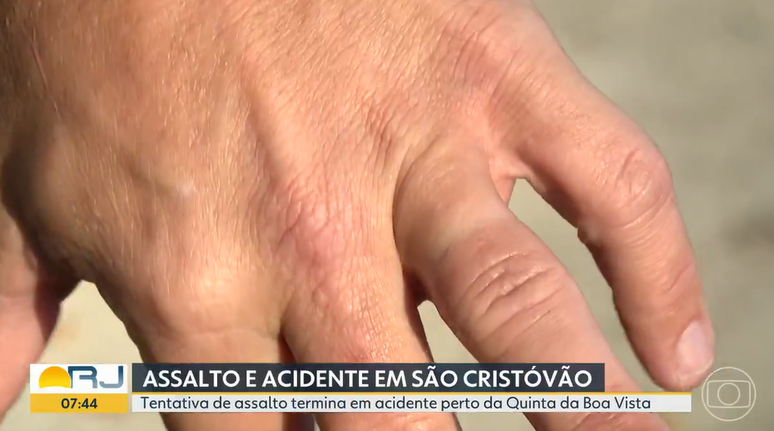 Ladrão usa os dentes para arrancar aliança de vítima durante assalto no Rio