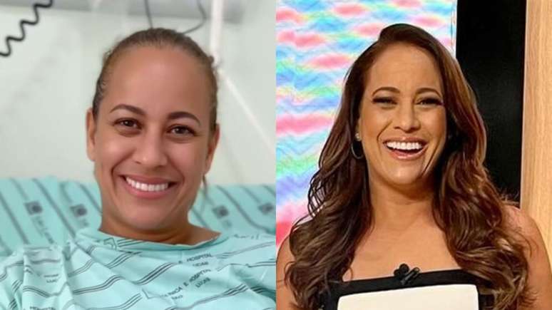 After leaving ‘Hoje em Dia’, Renata Alves underwent surgery; look how it went!