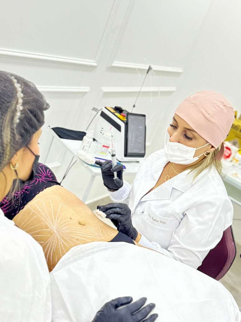 The treatment eliminates localized fat without invasive surgery