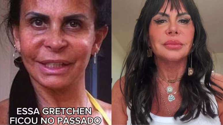 Antes e depois de Gretchen 