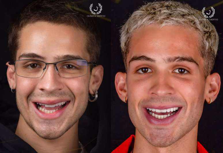 Antes e depois de João Guilherme