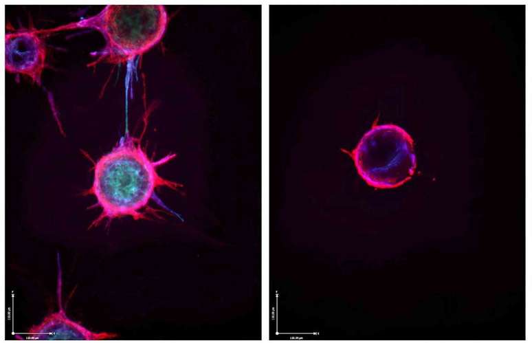 Imagem de microscopia justapondo células endoteliais com extensões que brotam para formar novos vasos sanguíneos e uma célula banhada em microRNA incapaz de brotar