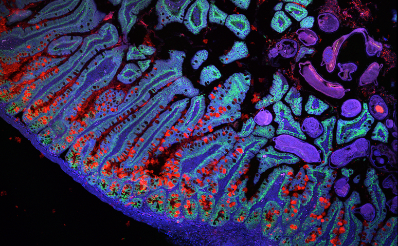 Arte ou ciência? Esta imagem mostra quantos genes são ativados para desenvolver o intestino delgado