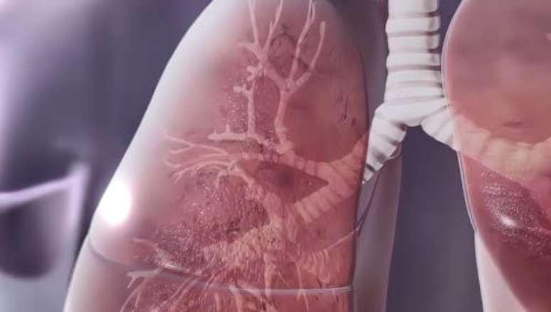 Ilustração do sistema respiratório: a fibrose cística é uma doença genética rara cujas mutações afetam principalmente os sistemas respiratório e digestivo, com impactos severos na saúde, frequentemente, levando à morte precoce pela perda progressiva da função pulmonar creativepic/Unlimphotos