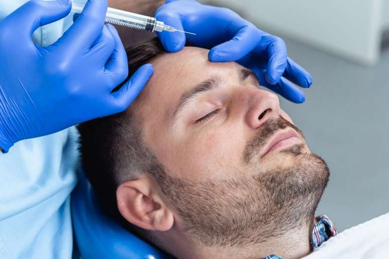 A aplicação de botox ajuda a suavizar rugas de expressão 