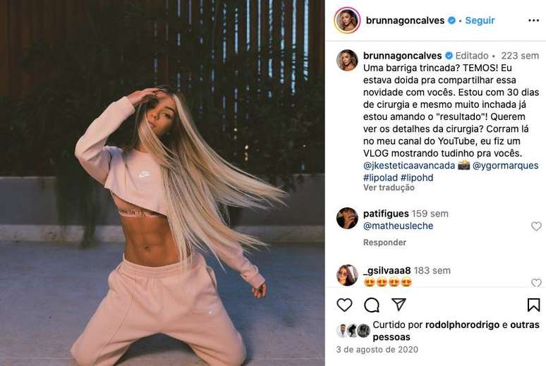 Brunna Gonçalves fez uma lipo LAD em 2020