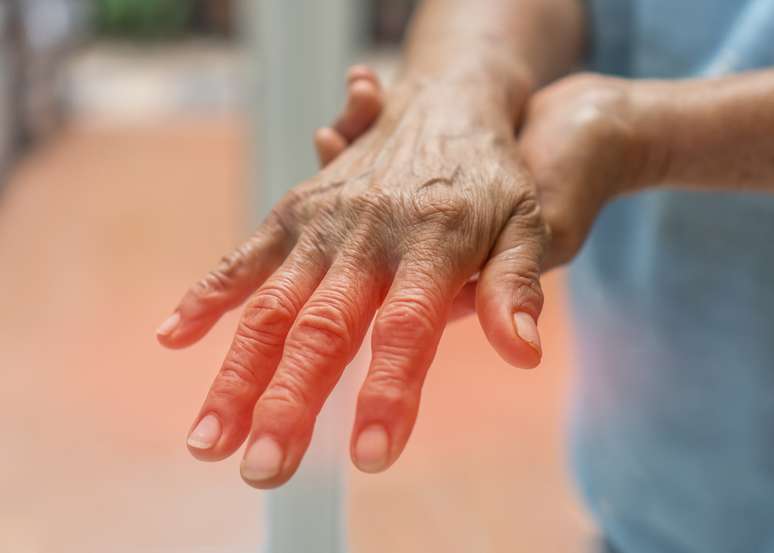 Formigamento ou dor nas mãos ou nos pés podem indicar danos aos nervos causados pelo diabetes