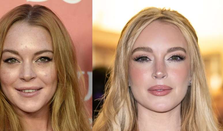 O que Lindsay Lohan fez no rosto? Aparência mais jovem da atriz choca a web e médico explica procedimentos.