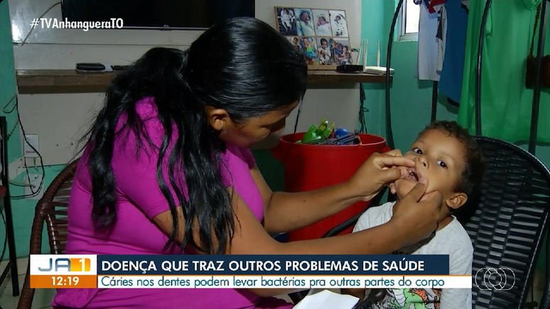 Mãe mostra situação dos dentes do filho em Palmas (TO)