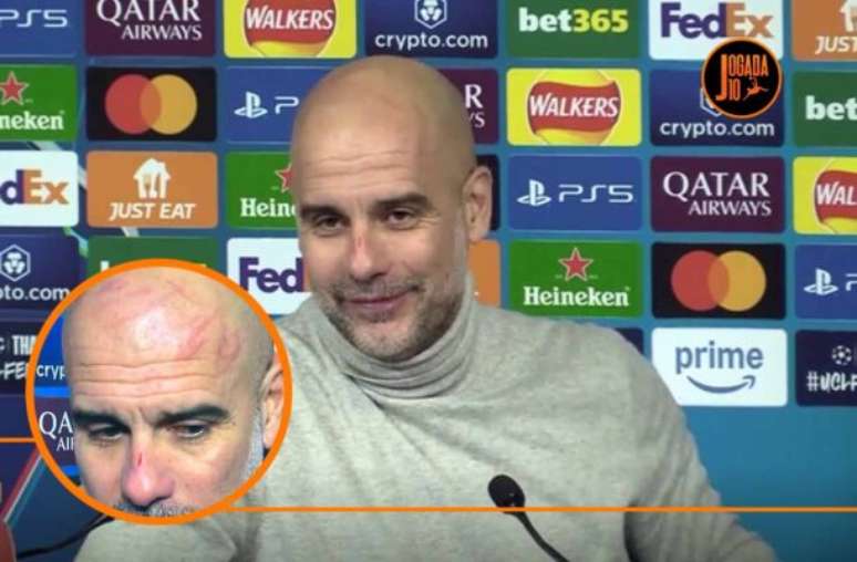 - Fotos: Reprodução - Legenda: Guardiola assustou os torcedores ao aparecer com o rosto repleto de arranhões