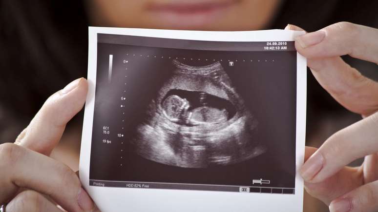 Woman with gynecological cancer repositions uterus and becomes pregnant
