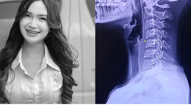 Cantora faleceu ap&oacute;s ter uma v&eacute;rtebra deslocada - Reprodu&ccedil;&atilde;o/YouTube