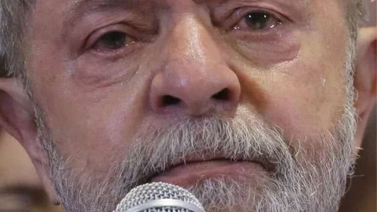 Lula é internado na UTI após ser diagnosticado com hemorragia intracraniana