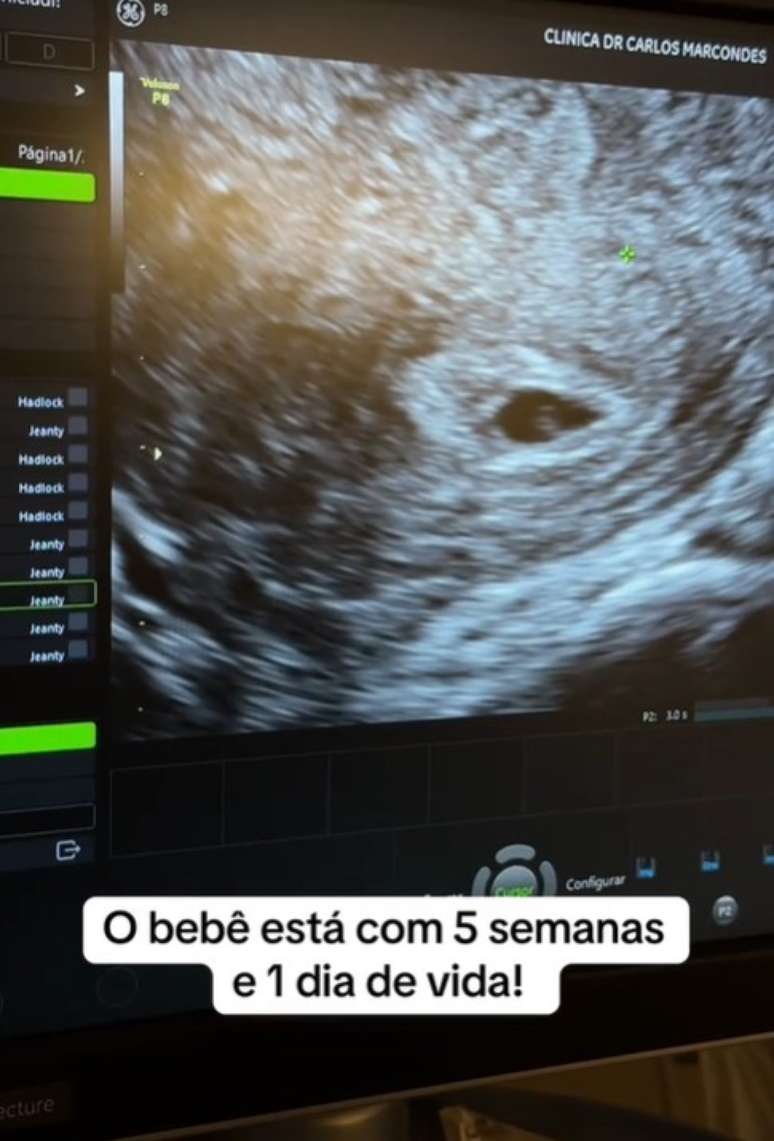 Reprodu&ccedil;&atilde;o/Tiktok