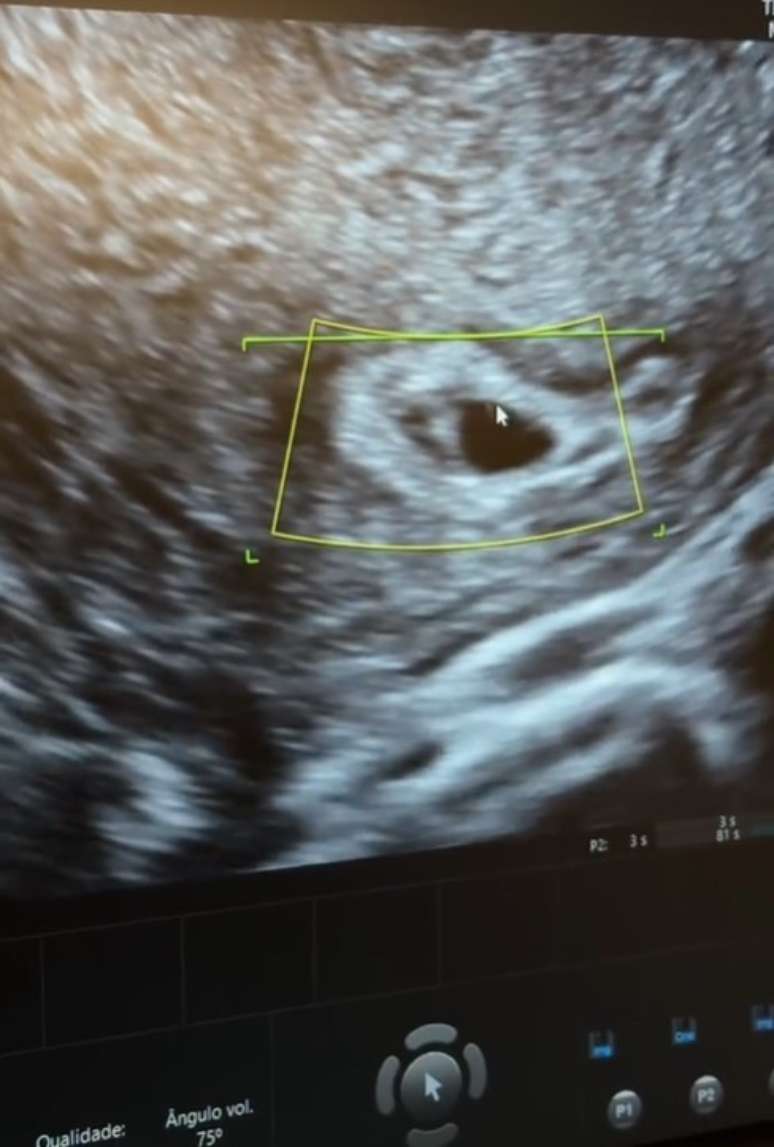 Reprodu&ccedil;&atilde;o/Tiktok