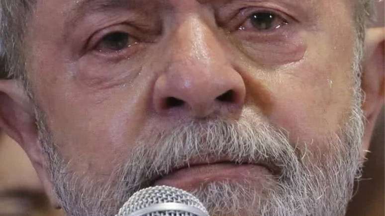 Lula entrega detalhes do acidente que o fez parar no hospital: 'Fez um estrago'