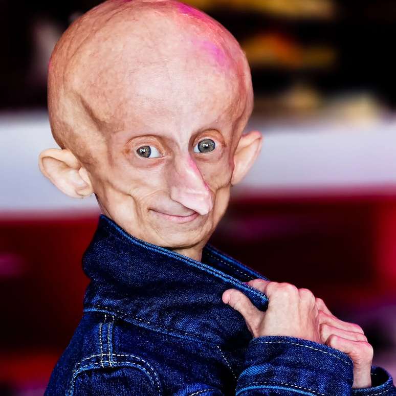 Morre Beandri Booysen, influenciadora que enfrentava doen&ccedil;a rara, aos 19 anos 