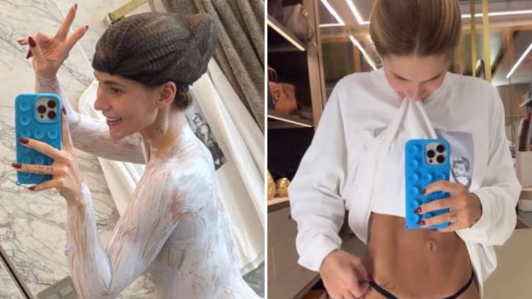 Pode isso? Virginia passa descolorante no corpo todo antes do Natal: 'Fazendo bronze'