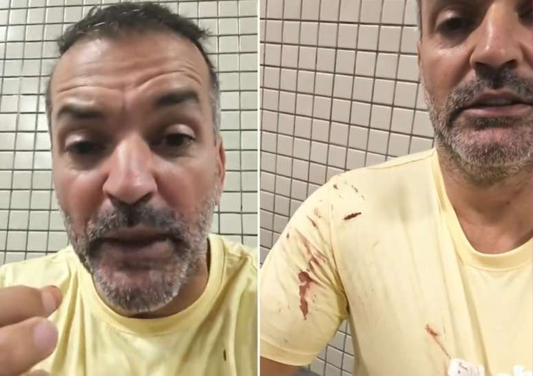 Pai afirma que filha de 14 anos foi atingida por bala perdida em Réveillon de Copacabana