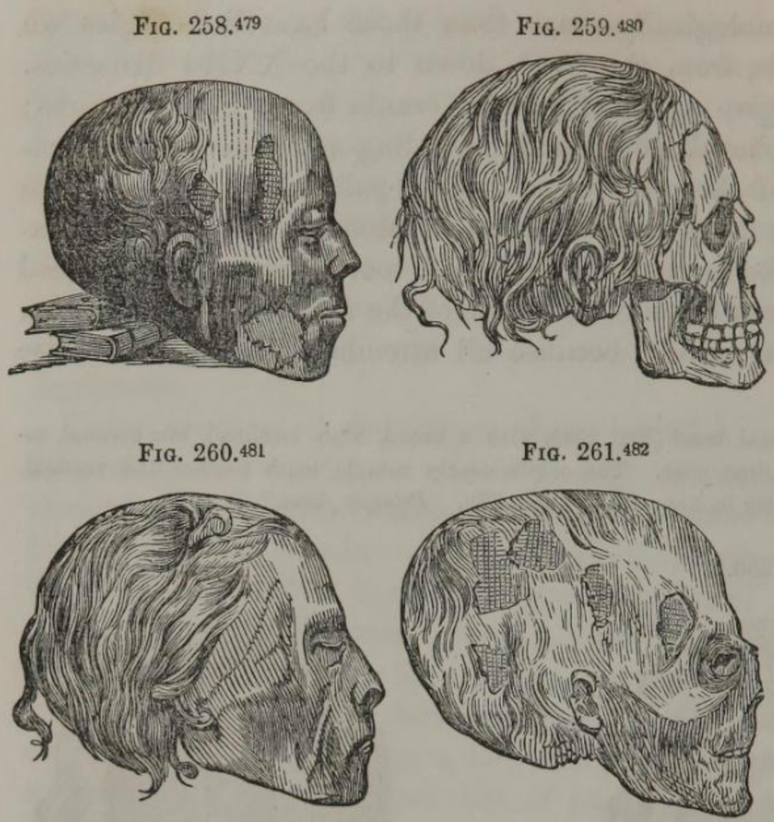 Ilustração representando quatro crânios diferentes