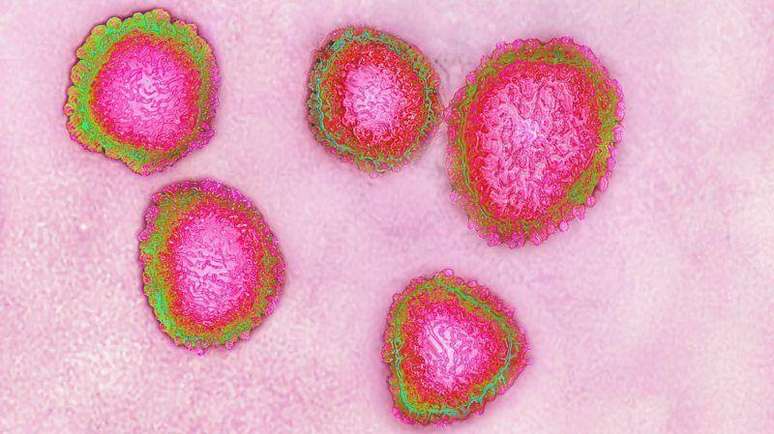 Cientistas preveem que a covid-19 irá evoluir até se tornar uma infecção leve, como os coronavírus que causam o resfriado comum.