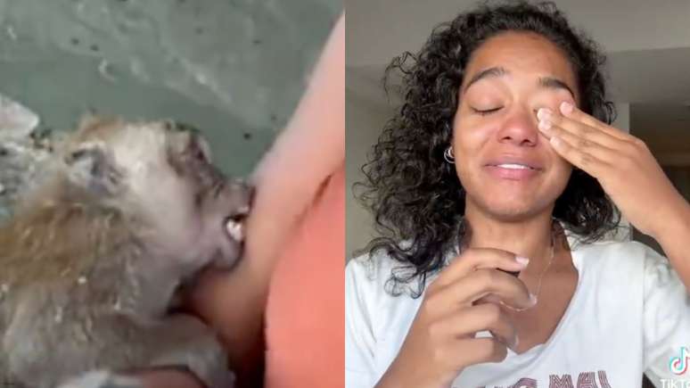 Influenciadora mordida por macaco na Tailândia retorna ao Brasil com reação alérgica