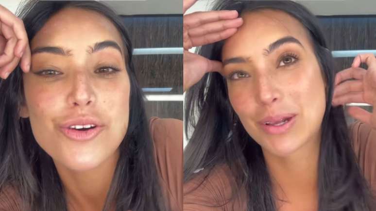 Vanessa Lopes comemora resultados de tratamento contra acne: 'Melhorando muito'