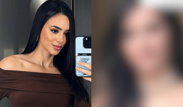 Bruna Biancardi revela foto antes da rinoplastia para massacrar internauta que a acusou de 'fazer muita plástica'. Veja antes e depois.