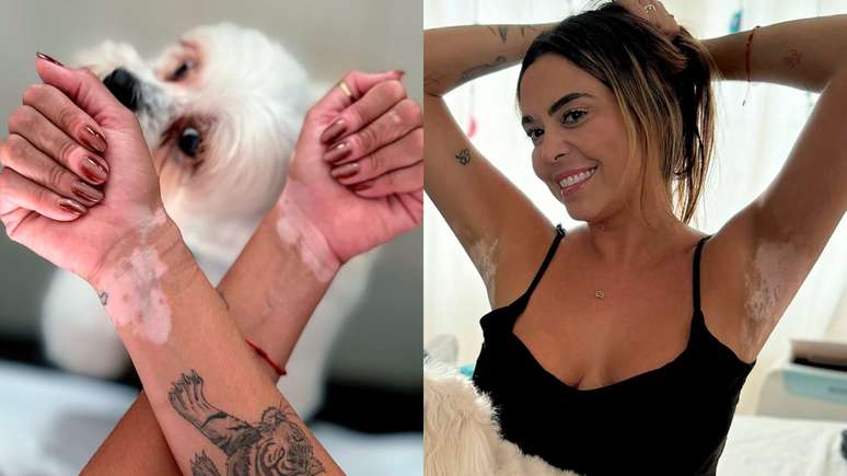 Marília Pinheiro fala sobre diagnóstico de vitiligo e aceitação: 'Faz parte de quem sou'