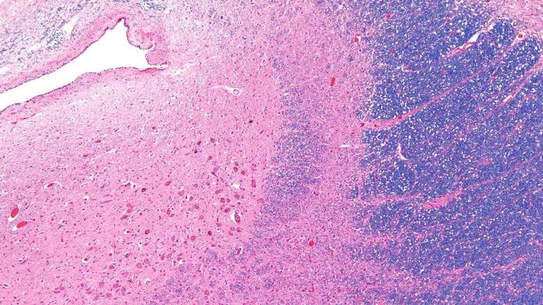 O locus coeruleus assume coloração azul viva com a produção do neurotransmissor norepinefrina