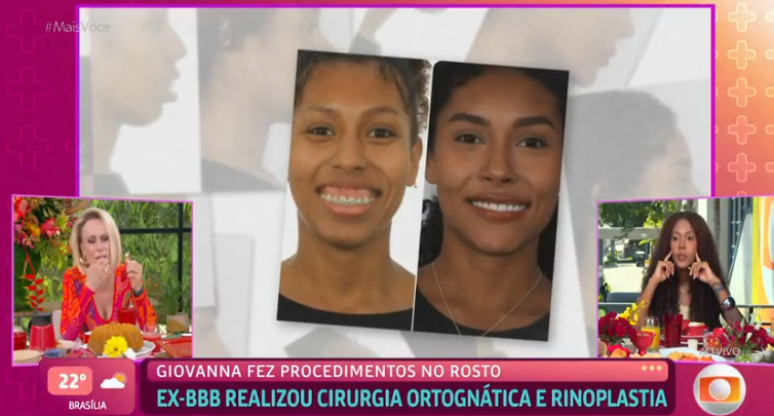 Giovanna conta sobre cirurgia ortognática no 'Mais Você'