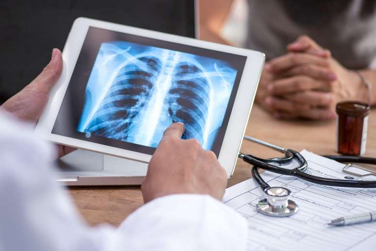 The lungs also have a regenerative capacity The lungs also have a regenerative capacity