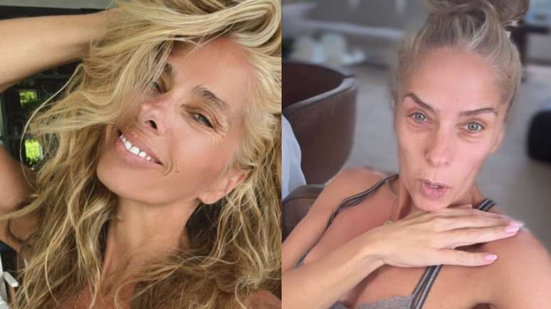 The doctor explains Adriane Galisteu’s assistance and treatment after surgery: “Variable”