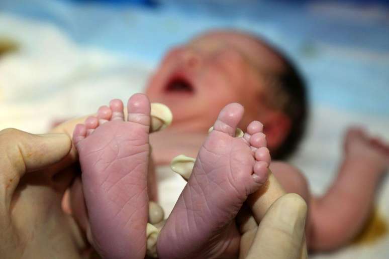 Pré-eclâmpsia aumenta significativamente as chances de nascimento prematuro