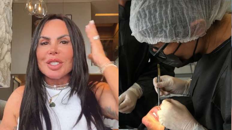Gretchen undergoes surgery to remove the dangerous substance from the lips: ’20 years’