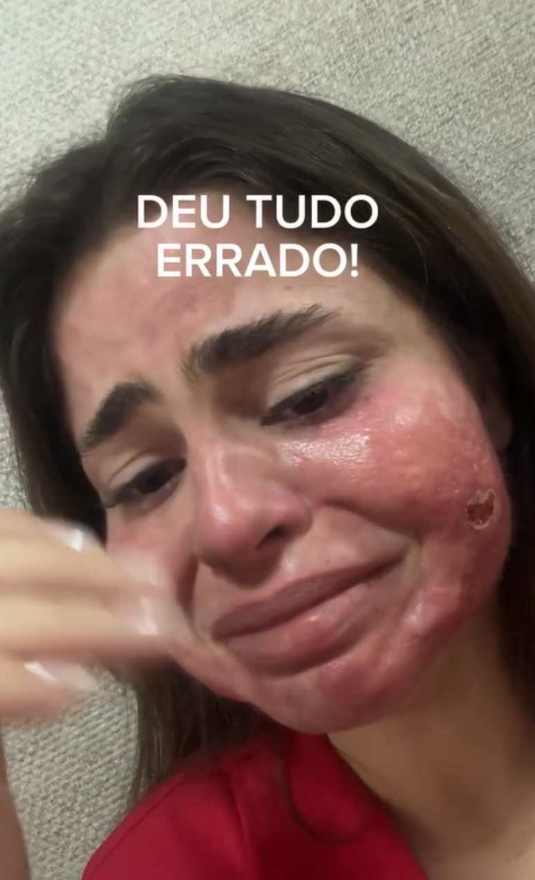 Reprodu&ccedil;&atilde;o/Instagram