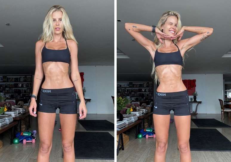 Yasmin Brunet mostra resultado de tratamento de lipedema