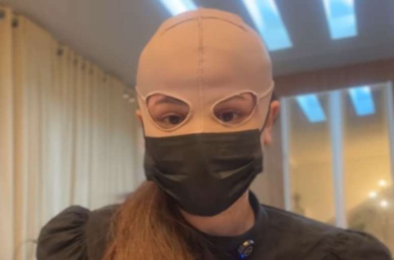 M&eacute;dica relatou que precisar&aacute; usar m&aacute;scara por seis meses devido &agrave;s queimaduras