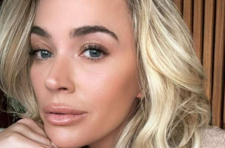 Teddi Mellencamp passará por cirurgia para remover tumores cerebrais