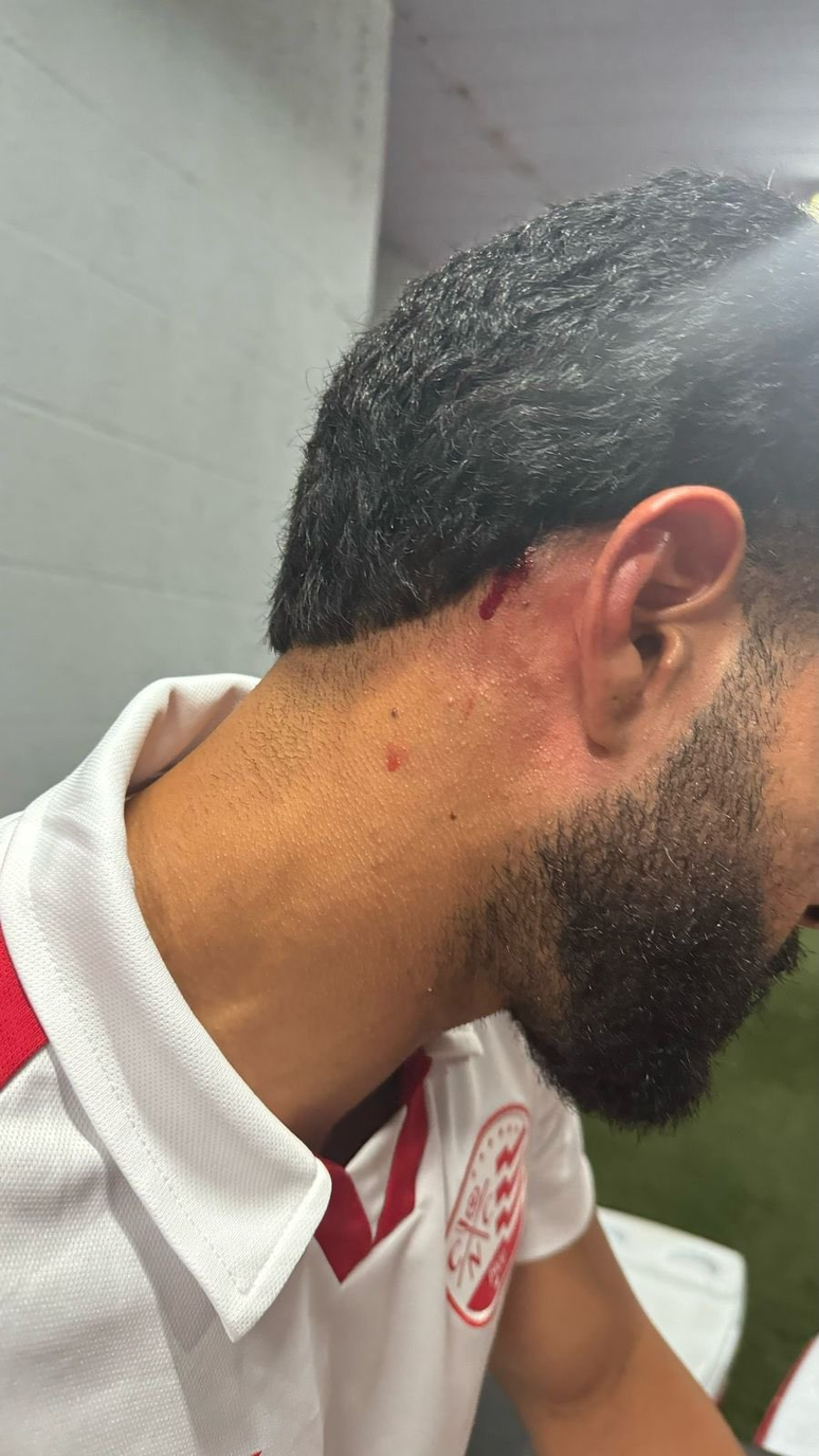 Massagista do Náutico foi atingido por uma pedrada. 