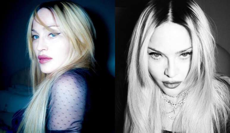 Madonna emerges younger and expert explains the trend: “thinner results”