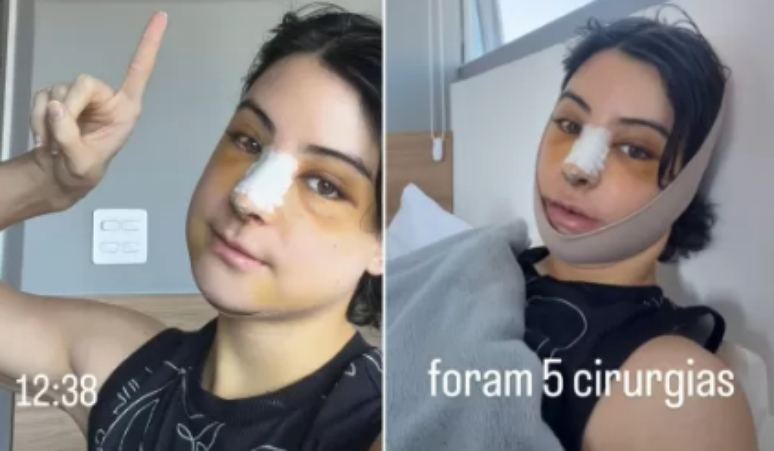 Zé Longuinho revela quantas e quais cirurgias já fez para feminização facial