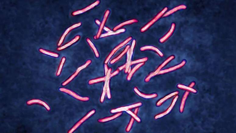 Os casos de tuberculose aumentaram no Reino Unido e em todo o mundo à medida que a doença aumenta sua resistência aos antibióticos