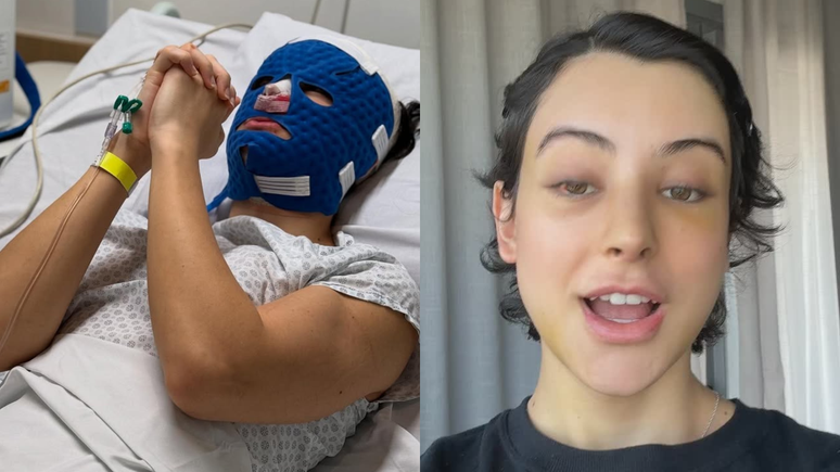 Zé Longuinho mostra resultado após cirurgia de feminização facial